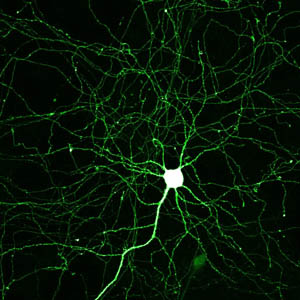 A microscopic picture of a cluster of neurons in the brain